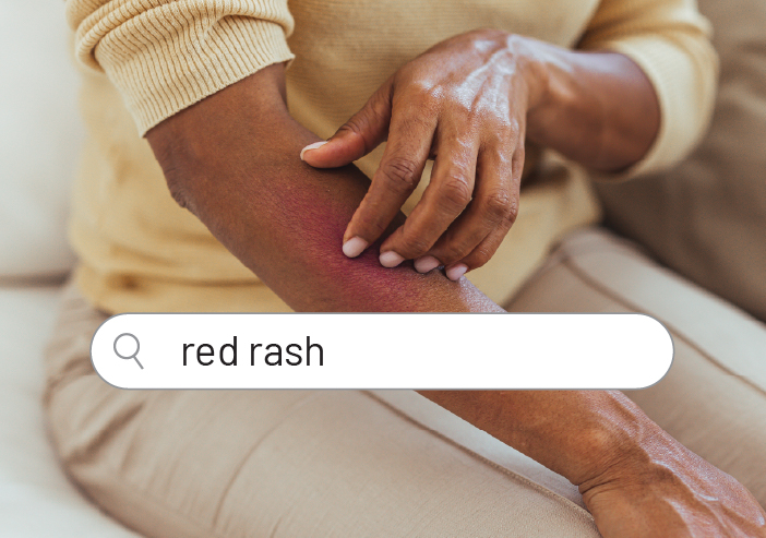red rash