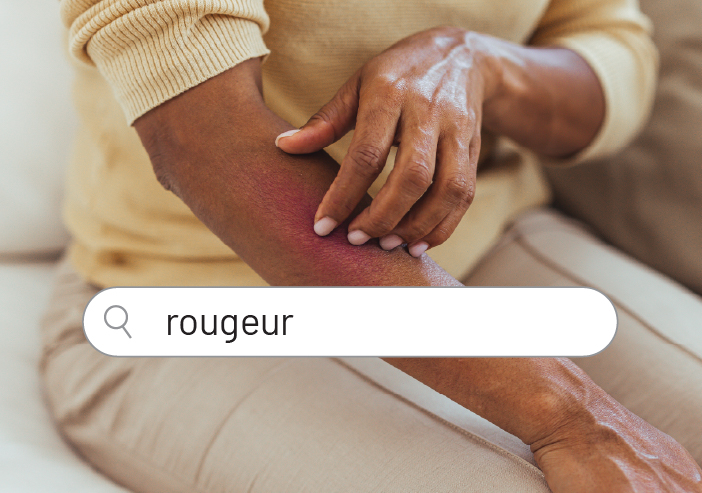 rougeur