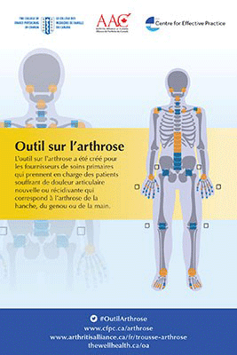 Outil sur l'arthrose