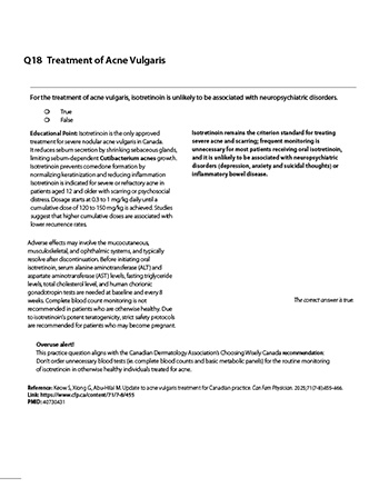 Q18 Treatment of Acne Vulgaris